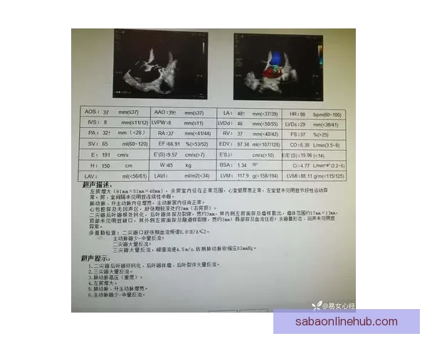 勇士伤情最新：霍福德波斯特康复顺利下周复查结果可期